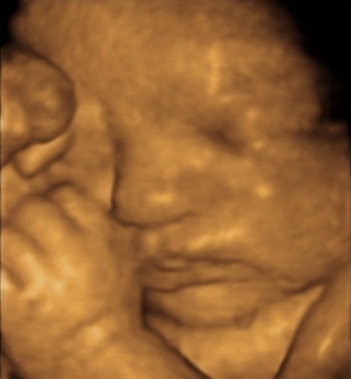 Ultrasound scans during antenatal visit by brisbane obstetrician
